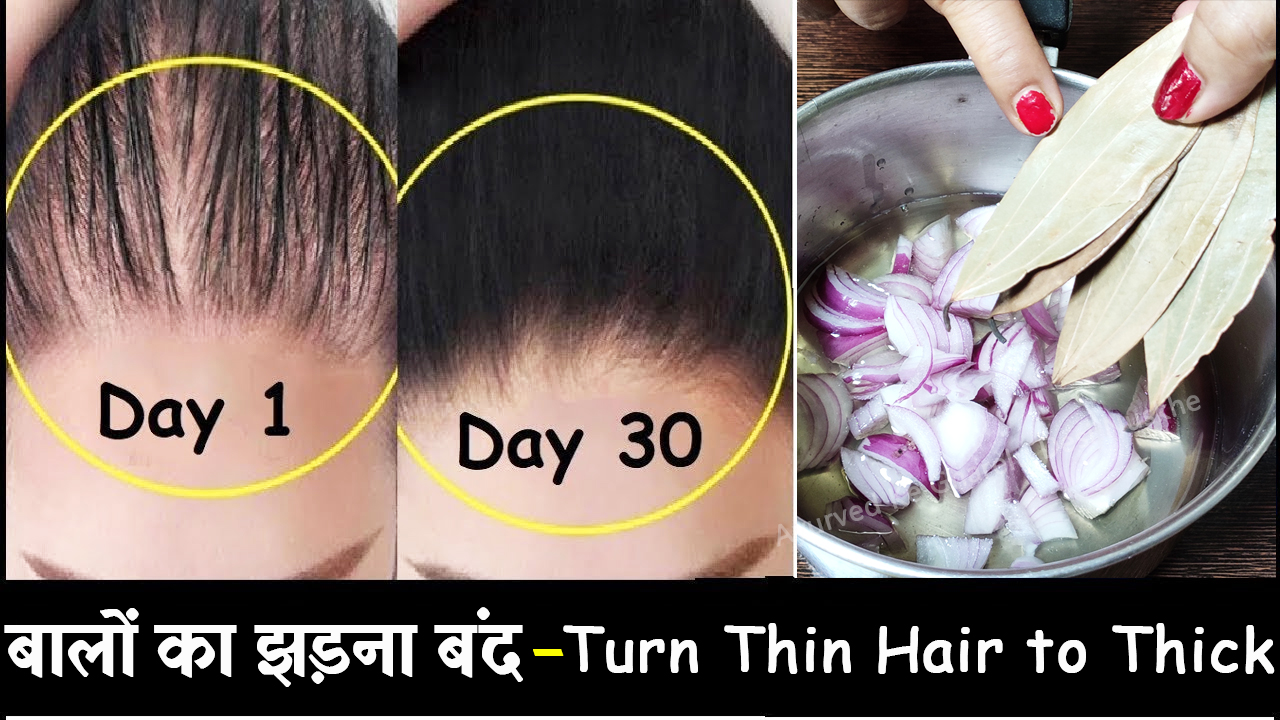 How to make Onion Oil, Bay leaves oil for Hair Growth, Double Hair Growth